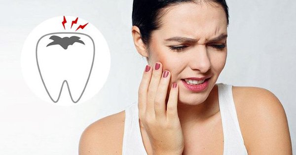 Nhổ răng khôn đau mấy ngày? Hướng dẫn chăm sóc sau nhổ răng