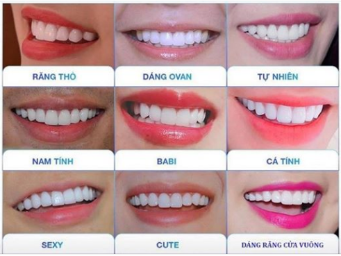 Bật mí những mẫu răng sứ đẹp nhất hiện nay? Lưu ý khi chọn mẫu răng phù hợp