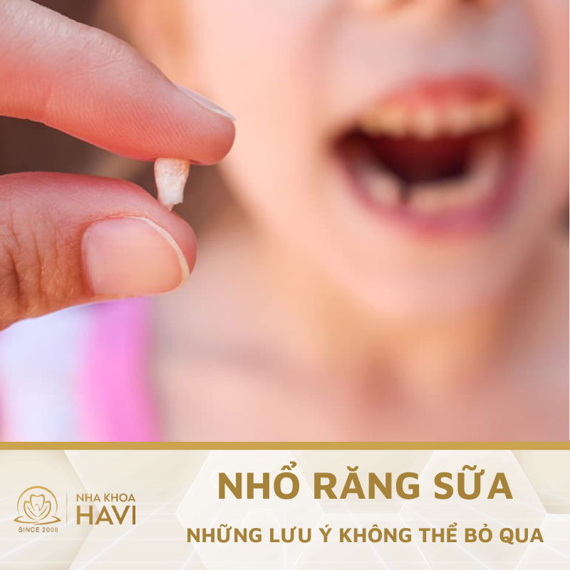 Nhổ răng sữa cho trẻ – Những lưu ý cha mẹ không thể bỏ qua