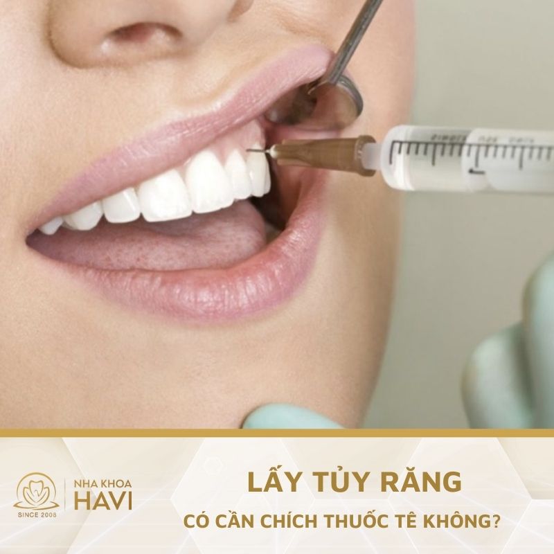 LẤY TỦY RĂNG CÓ CẦN CHÍCH THUỐC TÊ KHÔNG? GIẢI ĐÁP CHI TIẾT